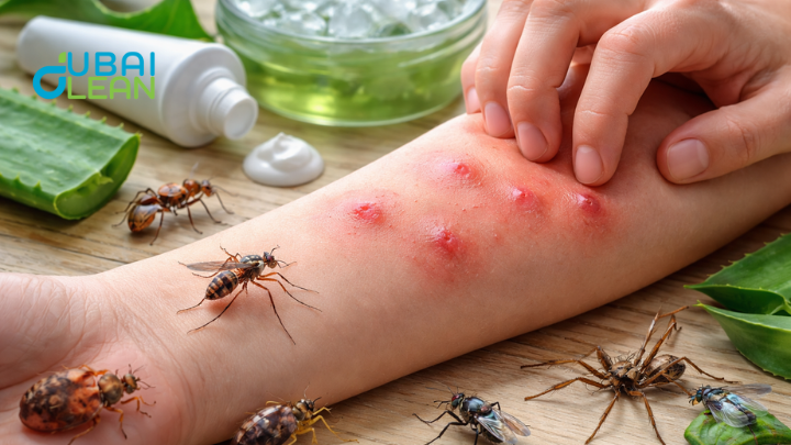 Pest Bite Skin Reaction