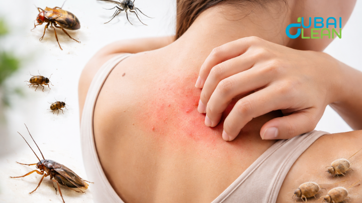 Pest-Related Itchy Skin Reactions - Causes, Symptoms & Care in Dubai Living in Dubai means enjoying a warm climate, modern homes, and an active lifestyle but it also means dealing with pests that thrive in heat and humidity. From bed bugs in apartments to mosquitoes near standing water, pest-related itchy skin reactions are a common yet frustrating problem for residents. That sudden itch, redness, or swelling on your skin is not just uncomfortable, it can signal an underlying pest infestation that needs urgent attention. In this expert guide, we’ll break down what causes pest-related itchy skin reactions, how to identify symptoms, prevention tips tailored for Dubai homes, and when to seek professional care. If you want real answers, long-term relief, and a healthier living environment, you’re in the right place. Why Pest-Related Itchy Skin Reactions Happen Pest-related itchy skin reactions are not random skin problems. They occur when your body responds to bites, allergens, or repeated exposure to household pests that are common in warm climates like Dubai. Understanding the reasons behind these reactions helps in early identification and long-term prevention. Insect Bites Trigger the Body’s Natural Defense System When pests such as bed bugs, mosquitoes, fleas, or mites bite the skin, they inject saliva or venom that contains proteins unfamiliar to the human body. The immune system treats these substances as a threat and releases histamines to protect the skin. This reaction causes itching, redness, swelling, and irritation. In Dubai, where bed bugs and mosquitoes are active throughout the year, these bites often appear overnight and mainly affect exposed areas like the arms, legs, neck, and face. The itching can become intense, especially at night, and scratching may worsen the skin condition or lead to infection. Allergens from Pests Cause Skin Irritation Without Visible Bites Not all pest-related itchy reactions come from direct bites. Many pests release allergens through droppings, shed skin, or microscopic particles that remain in carpets, mattresses, sofas, and air-conditioning systems. Dust mites and cockroaches are common sources of these allergens in Dubai homes, especially in humid indoor environments. When the skin comes into contact with these allergens, it can develop persistent itching, rashes, or dryness without obvious bite marks. This often leads to confusion, as people mistake the reaction for eczema or seasonal allergies. Continuous Exposure Makes Skin More Sensitive Over Time When a pest problem is left untreated, repeated exposure can cause the skin to become increasingly sensitive. Each new bite or contact triggers a stronger reaction than before, leading to chronic itching, inflammation, and sometimes painful sores. In shared residential buildings across Dubai, pests can easily spread between apartments, making repeated exposure more likely. Over time, the skin’s protective barrier weakens, increasing the risk of bacterial infections and scarring. This is why treating the infestation itself is essential, not just managing the skin symptoms. Signs and Symptoms of Pest-Related Itchy Skin Reactions Pest-related itchy skin reactions can look different from person to person, depending on the type of pest, skin sensitivity, and level of exposure. Recognizing the early signs and symptoms is important to prevent discomfort from turning into a long-term skin or health issue. Persistent Itching and Redness on Exposed Skin One of the earliest and most common signs of a pest-related itchy skin reaction is persistent itching accompanied by redness. This usually appears on exposed areas of the body such as the arms, legs, neck, shoulders, or face. The itching may start mild but often becomes more intense over time, especially at night when pests like bed bugs and mosquitoes are most active. In many cases, scratching provides temporary relief but ends up worsening the irritation, causing the skin to become inflamed, swollen, or even cracked. This symptom is especially common in Dubai homes where warm indoor temperatures allow pests to remain active year-round. Red Bumps, Rashes, or Clustered Bite Marks Another clear symptom is the appearance of red bumps, small rashes, or bite marks that may form in clusters or straight lines. Bed bug bites often show up in patterns, while flea bites are commonly found around the ankles and lower legs. Mosquito bites, on the other hand, appear as raised, itchy welts. These marks can vary in size and may darken over time, particularly on sensitive skin. In some cases, blisters or fluid-filled bumps may develop, indicating a stronger allergic reaction. If new marks continue to appear daily, it is often a sign of an ongoing pest infestation rather than a one-time exposure. Swelling, Burning Sensation, or Signs of Infection In more severe cases, pest-related skin reactions can cause noticeable swelling, warmth, or a burning sensation around the affected area. This usually happens when the body has a strong immune response or when repeated scratching damages the skin barrier. Open sores created by scratching can allow bacteria to enter, leading to infection. Symptoms of infection may include pus, pain, increased redness, or fever. In Dubai’s humid climate, these infections can worsen quickly if not treated properly. At this stage, both medical attention and professional pest control become necessary to stop the cycle of irritation and exposure. Myths vs Facts About Pest-Related Itchy Skin Reactions There are many misconceptions surrounding pest-related itchy skin reactions, which often lead people to ignore the real cause or delay proper treatment. Understanding the difference between myths and facts helps you take the right action early and prevent recurring skin irritation and pest infestations. Myth Fact Itchy skin reactions are always caused by allergies or sensitive skin Pest bites and pest allergens are a common cause of itchy skin, especially in warm climates like Dubai where pests are active year-round If there are no visible bite marks, pests are not the problem Many pests, such as dust mites and cockroaches, cause itching through allergens without leaving visible bite marks Bed bugs only exist in dirty homes Bed bugs can infest even clean, well-maintained homes and are often brought in through luggage, furniture, or shared buildings Mosquito bites are harmless and do not need attention Scratching mosquito bites can lead to skin infections, scarring, and prolonged irritation if not treated properly Home remedies alone can permanently solve pest-related skin issues Home remedies may soothe symptoms, but professional pest control is needed to eliminate the root cause Pest problems go away on their own over time Without proper treatment, pest infestations often worsen and cause repeated skin reactions Why DubaiClean Is a Trusted Choice for Pest Control in Dubai Choosing the right pest control service is essential to protect your home and family from recurring itchy skin reactions and infestations. DubaiClean has earned the trust of residents across the city by providing safe, effective, and long-lasting solutions tailored to Dubai’s unique environment. Dubai-Specific Expertise: We understand the pests that are most common in Dubai homes and apartments, from bed bugs to mosquitoes and fleas. Safe and Eco-Friendly Treatments: All our solutions are approved, child-safe, and pet-friendly, ensuring a healthy living environment. Thorough Inspections: Our trained technicians identify hidden infestations, entry points, and high-risk areas before treatment. Targeted Pest Control: We provide pest-specific treatments that eliminate the problem at the source, not just temporarily relieve symptoms. Long-Term Prevention Advice: We educate homeowners on maintaining pest-free spaces with simple, effective measures. Experienced and Professional Team: Our certified technicians are skilled, reliable, and equipped to handle both small and large-scale infestations. Transparent Pricing and Follow-Ups: We offer clear service plans with follow-up inspections to prevent pests from returning. Conclusion Pest-related itchy skin reactions are more than just a minor inconvenience they are a clear signal that pests are affecting your home and your health. From bed bugs and mosquitoes to fleas and dust mites, these tiny invaders can cause persistent itching, rashes, and even infections if left untreated. Preventing and addressing these reactions requires a combination of proper home hygiene, awareness of common symptoms, and professional pest control services. While home remedies can provide temporary relief, only expert solutions can eliminate pests at the source and ensure your home stays safe and itch-free.
